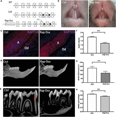 Conditional Knockout of Raptor/mTORC1 Results in Dentin Malformation